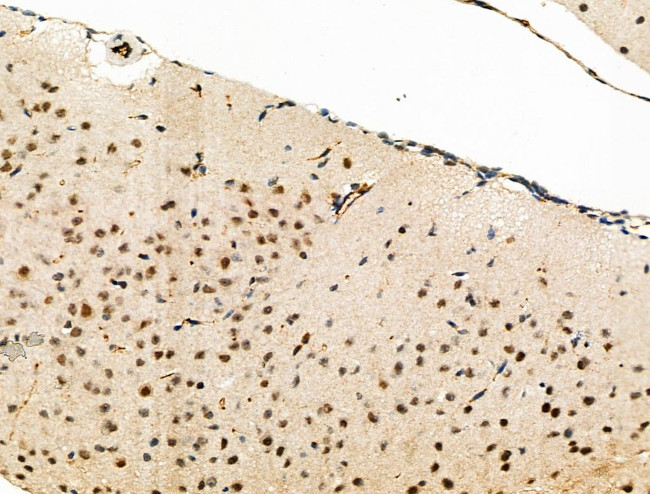 Phospho-eIF2 beta (Ser2) Antibody in Immunohistochemistry (Paraffin) (IHC (P))