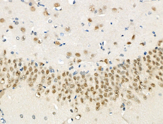 Phospho-eIF2 beta (Ser2) Antibody in Immunohistochemistry (Paraffin) (IHC (P))