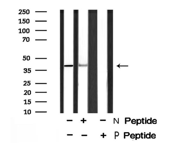 Phospho-eIF2 beta (Ser2) Antibody in Western Blot (WB)