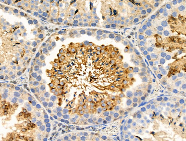 Phospho-eIF5 (Ser389, Ser390) Antibody in Immunohistochemistry (Paraffin) (IHC (P))