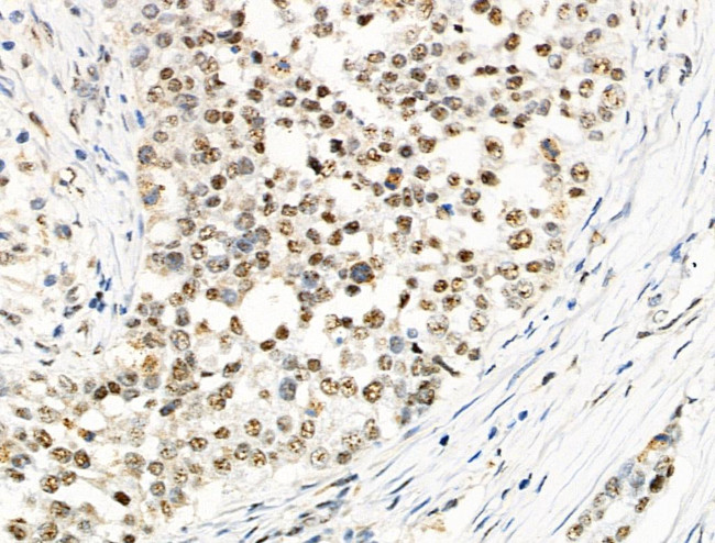 Phospho-EIF6 (Ser235) Antibody in Immunohistochemistry (Paraffin) (IHC (P))