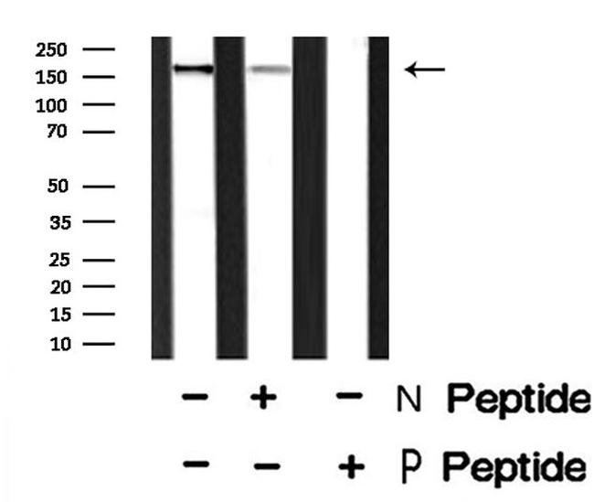 Phospho-FANCD2 (Thr691) Antibody in Western Blot (WB)