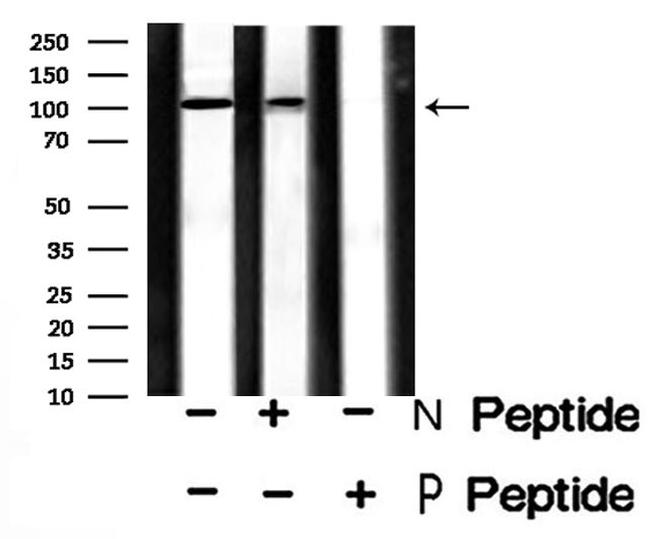 Phospho-GluR2 (Tyr876) Antibody in Western Blot (WB)