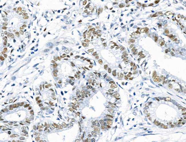 Phospho-INCENP (Thr59) Antibody in Immunohistochemistry (Paraffin) (IHC (P))