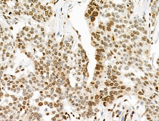 Phospho-INCENP (Thr59) Antibody in Immunohistochemistry (Paraffin) (IHC (P))