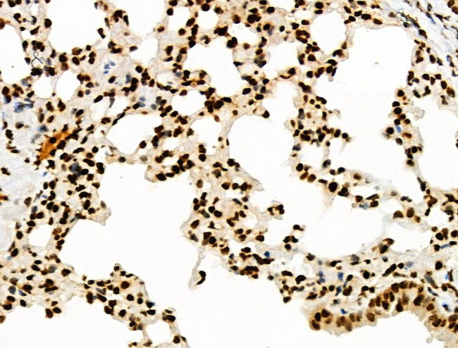 Phospho-INCENP (Thr59) Antibody in Immunohistochemistry (Paraffin) (IHC (P))