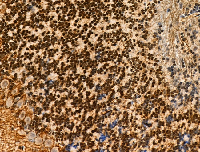 Phospho-INCENP (Thr59) Antibody in Immunohistochemistry (Paraffin) (IHC (P))