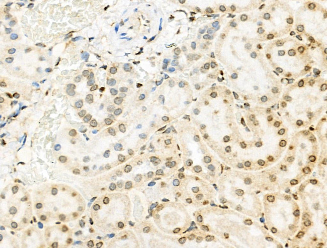 Phospho-INCENP (Thr59) Antibody in Immunohistochemistry (Paraffin) (IHC (P))