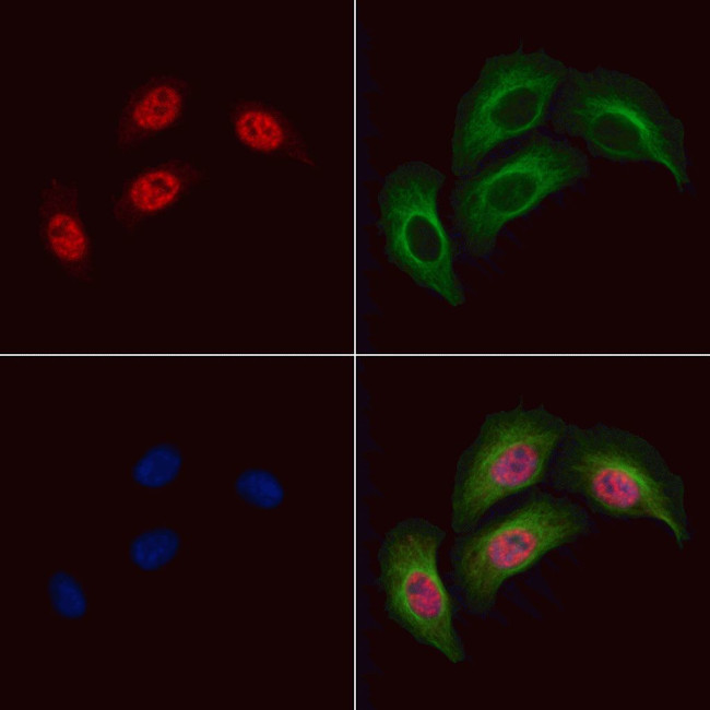 Phospho-INCENP (Thr59) Antibody in Immunocytochemistry (ICC/IF)