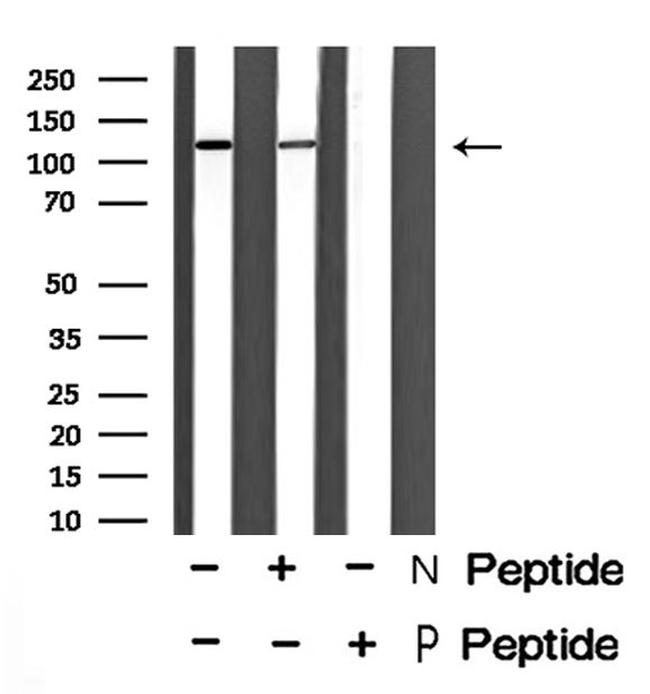 Phospho-INCENP (Thr59) Antibody in Western Blot (WB)