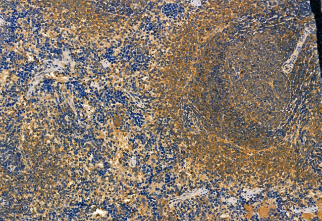 Phospho-IRF7 (Ser477) Antibody in Immunohistochemistry (Paraffin) (IHC (P))