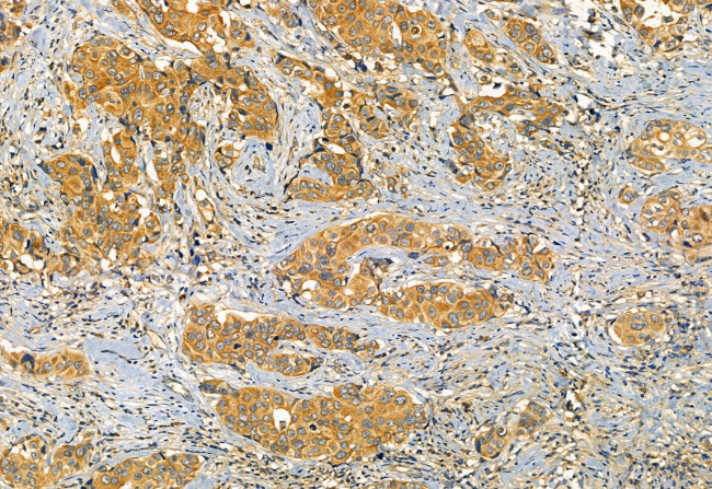 Phospho-IRF7 (Ser477) Antibody in Immunohistochemistry (Paraffin) (IHC (P))