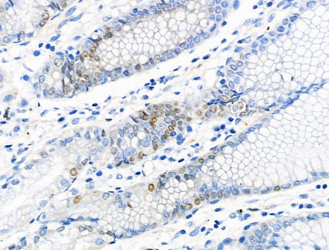 Phospho-MCM2 (Ser139) Antibody in Immunohistochemistry (Paraffin) (IHC (P))