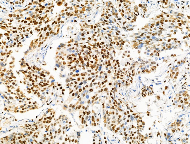 Phospho-MCM2 (Ser139) Antibody in Immunohistochemistry (Paraffin) (IHC (P))