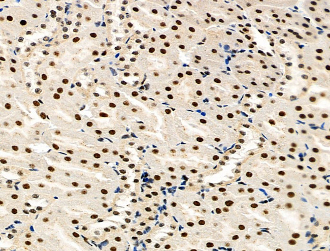 Phospho-MCM2 (Ser139) Antibody in Immunohistochemistry (Paraffin) (IHC (P))