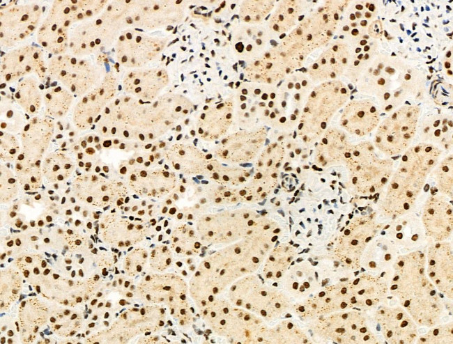 Phospho-MCM2 (Ser139) Antibody in Immunohistochemistry (Paraffin) (IHC (P))