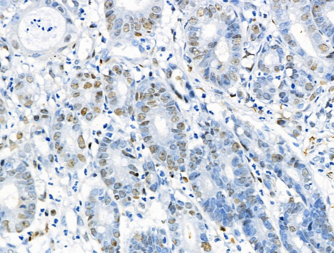 Phospho-MCM2 (Ser139) Antibody in Immunohistochemistry (Paraffin) (IHC (P))