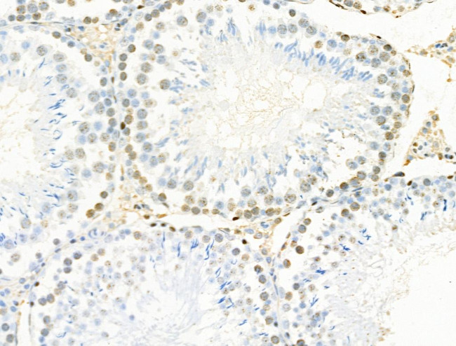 Phospho-MCM2 (Ser139) Antibody in Immunohistochemistry (Paraffin) (IHC (P))