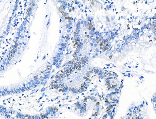 Phospho-MCM2 (Ser139) Antibody in Immunohistochemistry (Paraffin) (IHC (P))