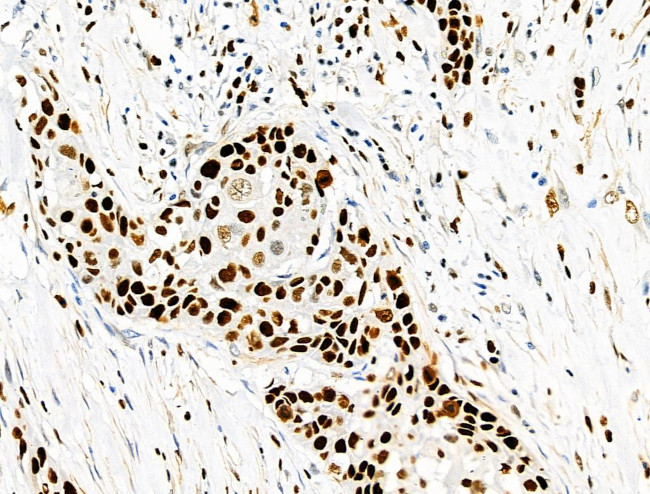 Phospho-MCM2 (Ser139) Antibody in Immunohistochemistry (Paraffin) (IHC (P))