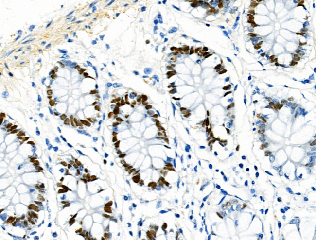 Phospho-MCM2 (Ser139) Antibody in Immunohistochemistry (Paraffin) (IHC (P))