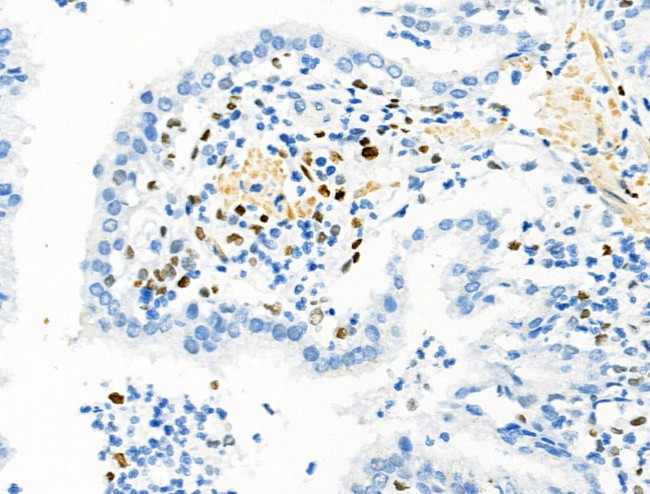 Phospho-MCM2 (Ser139) Antibody in Immunohistochemistry (Paraffin) (IHC (P))