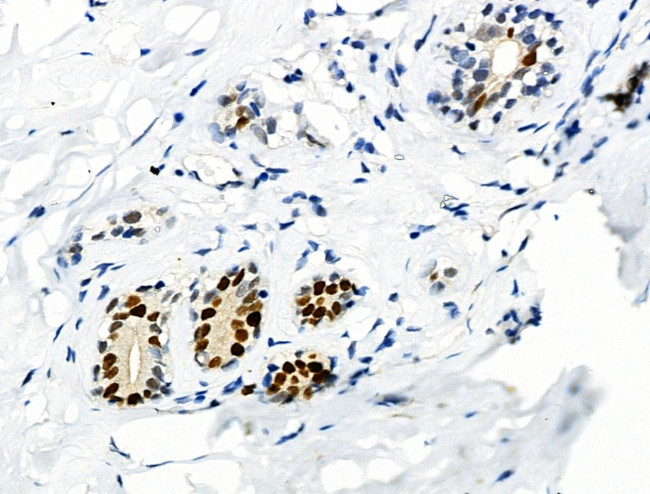 Phospho-MCM2 (Ser27) Antibody in Immunohistochemistry (Paraffin) (IHC (P))