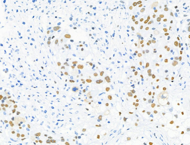 Phospho-MCM2 (Ser27) Antibody in Immunohistochemistry (Paraffin) (IHC (P))