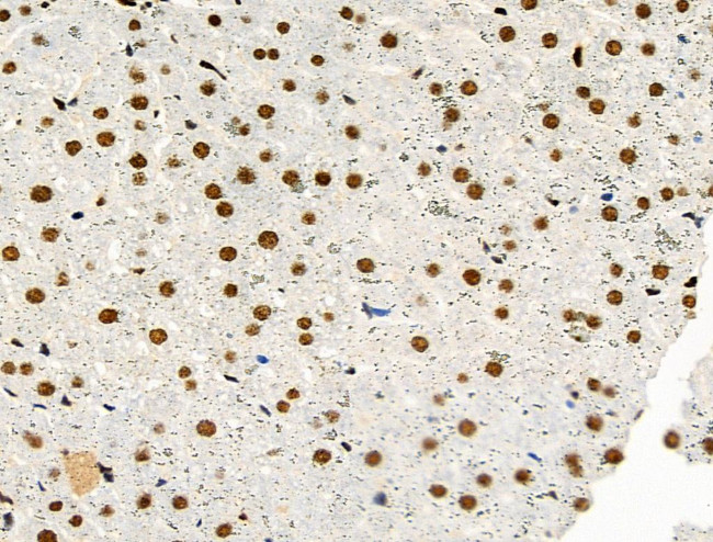 Phospho-MCM2 (Ser27) Antibody in Immunohistochemistry (Paraffin) (IHC (P))