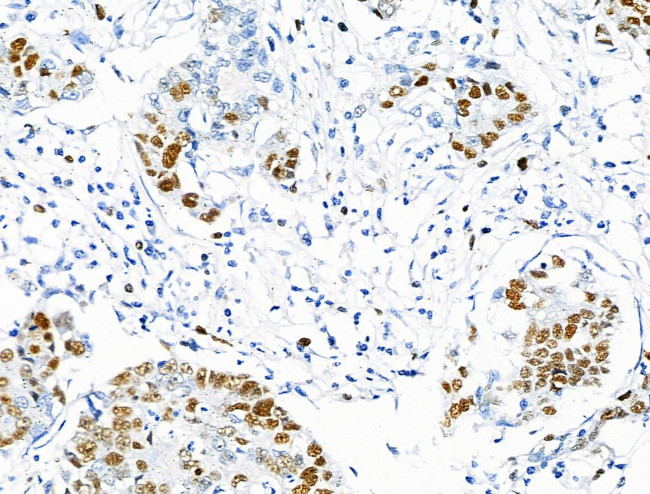 Phospho-MCM2 (Ser27) Antibody in Immunohistochemistry (Paraffin) (IHC (P))