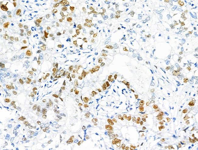 Phospho-MCM2 (Ser27) Antibody in Immunohistochemistry (Paraffin) (IHC (P))