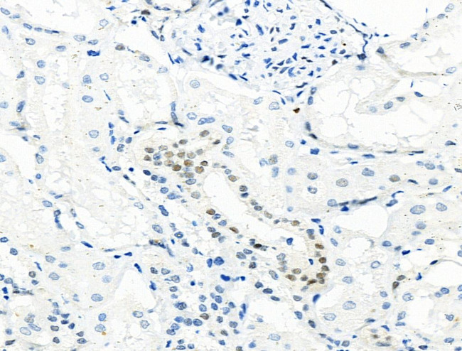 Phospho-MCM2 (Ser27) Antibody in Immunohistochemistry (Paraffin) (IHC (P))