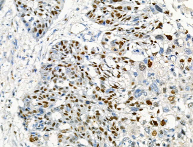 Phospho-MCM2 (Ser53) Antibody in Immunohistochemistry (Paraffin) (IHC (P))