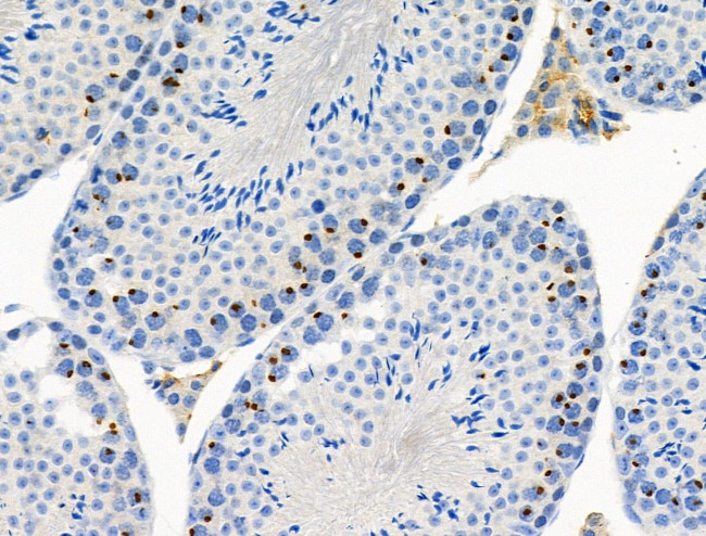 Phospho-MCM2 (Ser53) Antibody in Immunohistochemistry (Paraffin) (IHC (P))