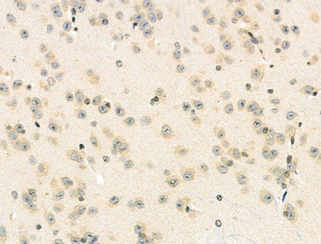 Phospho-MyD88 (Tyr257) Antibody in Immunohistochemistry (Paraffin) (IHC (P))