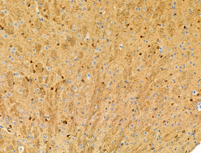 Phospho-Nudel (Thr219) Antibody in Immunohistochemistry (Paraffin) (IHC (P))