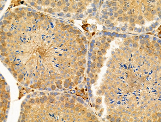 Phospho-Nudel (Thr219) Antibody in Immunohistochemistry (Paraffin) (IHC (P))