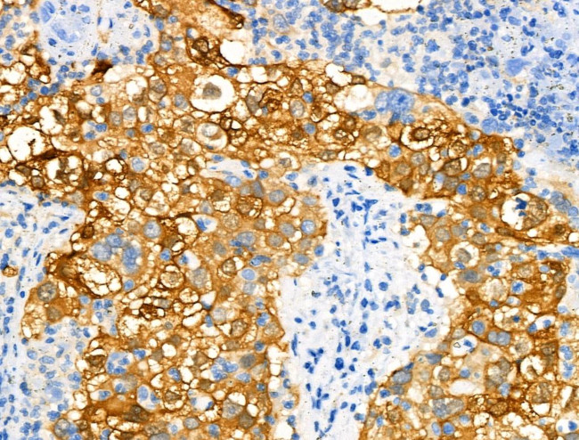 Phospho-NDRG1 (Ser330) Antibody in Immunohistochemistry (Paraffin) (IHC (P))