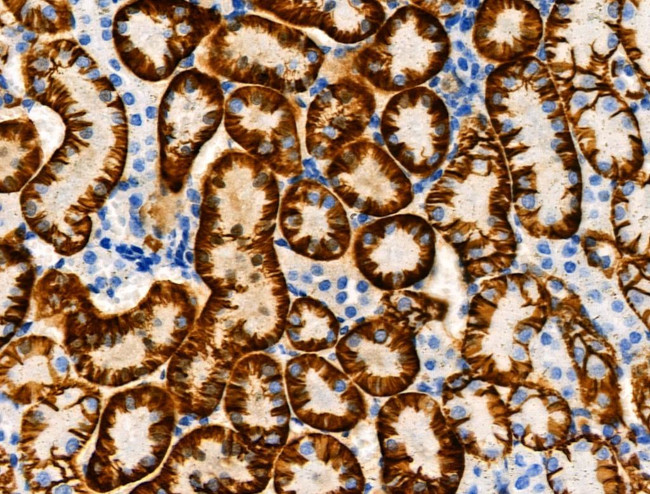 Phospho-NDRG1 (Ser330) Antibody in Immunohistochemistry (Paraffin) (IHC (P))