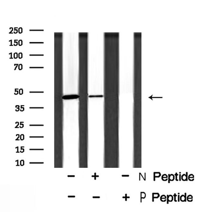 Phospho-NDRG1 (Ser330) Antibody in Western Blot (WB)