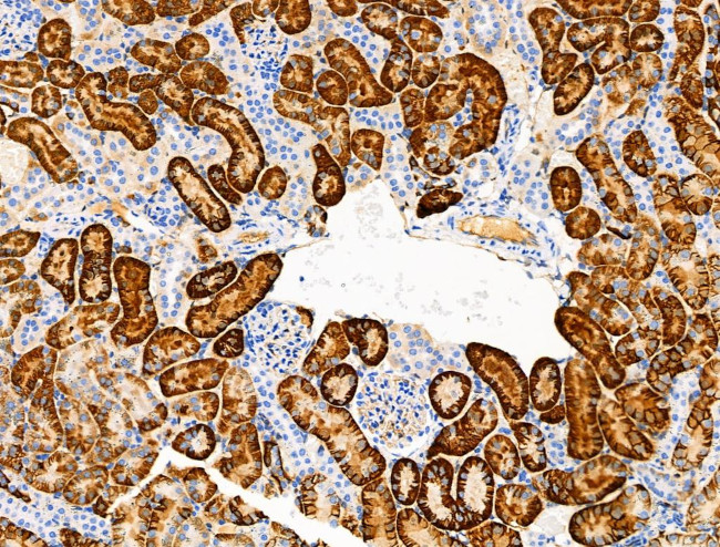 Phospho-NDRG1 (Thr346) Antibody in Immunohistochemistry (Paraffin) (IHC (P))