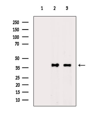 Phospho-NPM1 (Ser70) Antibody in Western Blot (WB)