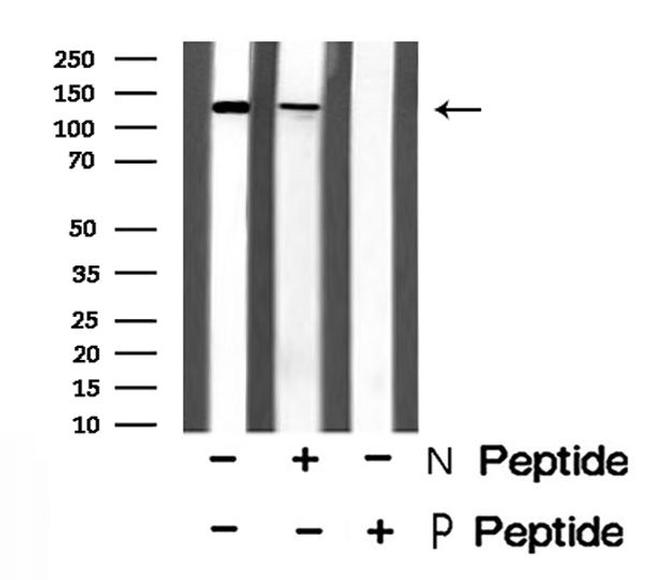 Phospho-PDE3A (Ser312) Antibody in Western Blot (WB)