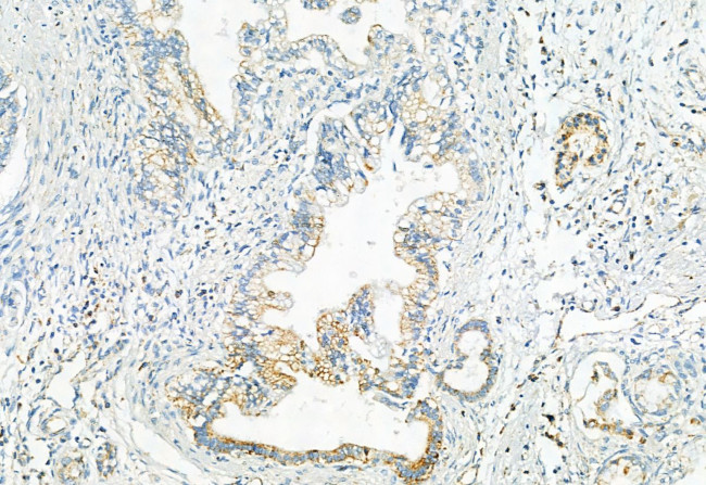 Phospho-PDHA1/PDHA2 (Ser293, Ser291) Antibody in Immunohistochemistry (Paraffin) (IHC (P))