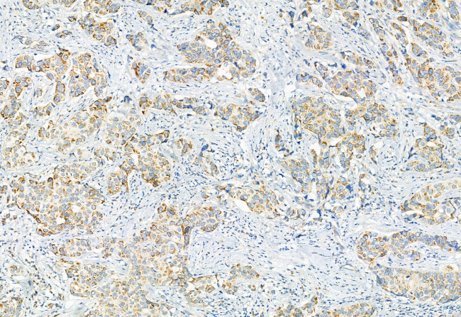 Phospho-PDHA1/PDHA2 (Ser293, Ser291) Antibody in Immunohistochemistry (Paraffin) (IHC (P))