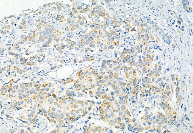 Phospho-PDHA1/PDHA2 (Ser293, Ser291) Antibody in Immunohistochemistry (Paraffin) (IHC (P))