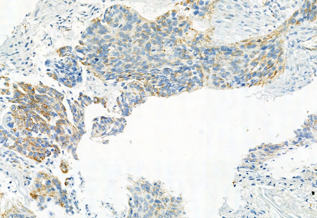 Phospho-PDHA1/PDHA2 (Ser293, Ser291) Antibody in Immunohistochemistry (Paraffin) (IHC (P))