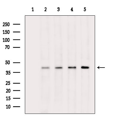 Phospho-PDHA1/PDHA2 (Ser293, Ser291) Antibody in Western Blot (WB)