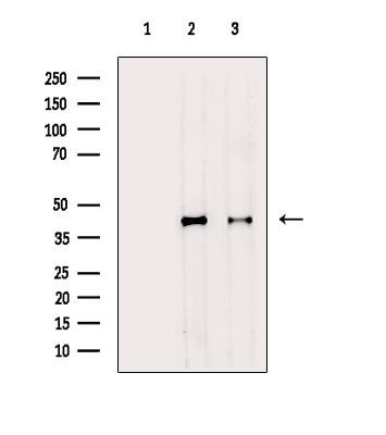 Phospho-PDHA1/PDHA2 (Ser293, Ser291) Antibody in Western Blot (WB)