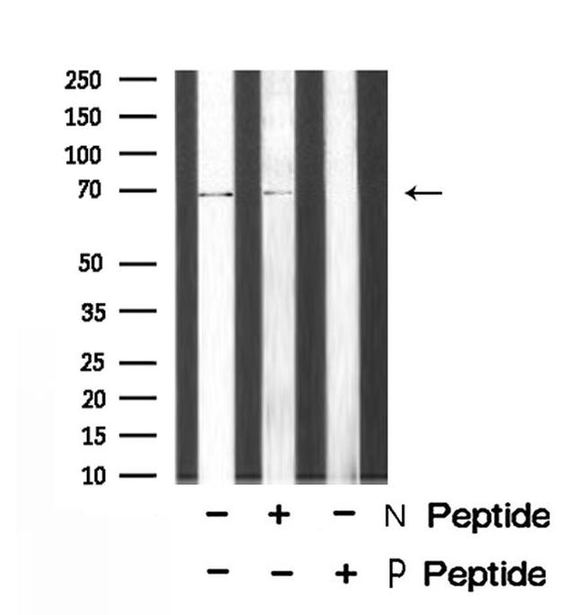 Phospho-Torc1 (Ser151) Antibody in Western Blot (WB)